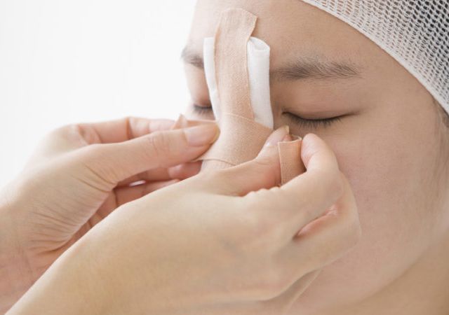 Women undergoing shaping nose